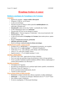 Cours 18 oesophage brulure et cancer