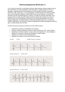 Electrocardiogramme (ECG) (doc 1)