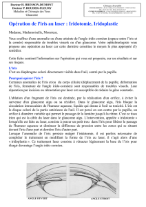 l_iridotomie_au_laser_fiche sfo IP pour le site internet