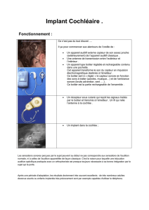 implant-cochleaire - Le Site du Dr. Hibbert