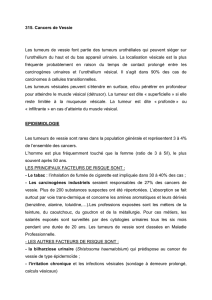 Cancers de Vessie (corpus)