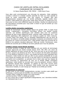 choix de lentilles intra-oculaires