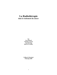 La radiothérapie dans le traitement du cancer