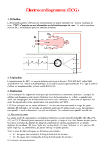 Électrocardiogramme (ÉCG) - Société Française des Infirmier(e)s