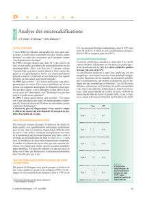 Analyse des microcalcifications