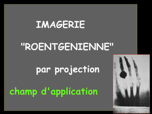 IMAGERIE "ROENTGENIENNE" par projection champ d`application