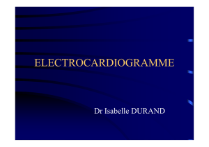 ELECTROCARDIOGRAMME