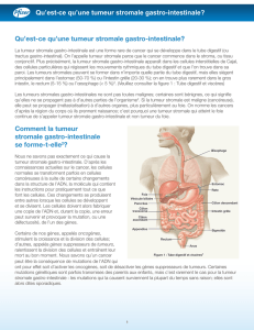 Qu`est-ce qu`une tumeur stromale gastro-intestinale?