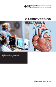 Cardioversion électrique - Bibliothèque médicale HMR