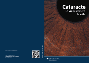 Cataracte - Fondation Asile des aveugles