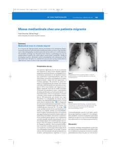 Masse médiastinale chez une patiente migrante