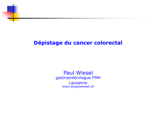 Dépistage du cancer colorectal (Dr Wiesel)