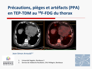 PPA en TEP-TDM au 18FDG du thorax - Dr Jean Simon