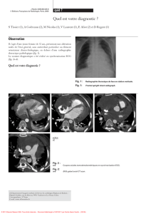 Quel est votre diagnostic