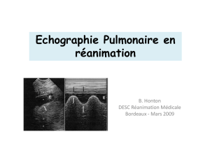 Echographie Pulmonaire en réanimation