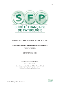pathologie prostatique - Société Française de Pathologie