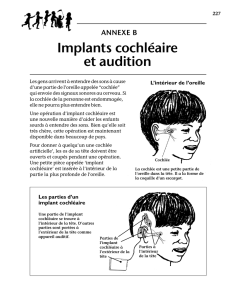 Annexe B : Implants cochléaire et audition