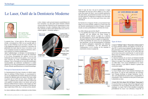 Le Laser, Outil de la Dentisterie Moderne
