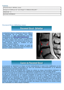 Pincement Discal lombalgie medication