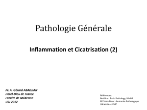 Inflammation - epathologies