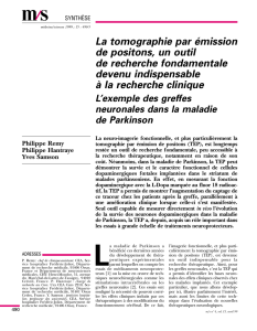 La tomographie par &eacute;mission de positons, un outil de - iPubli