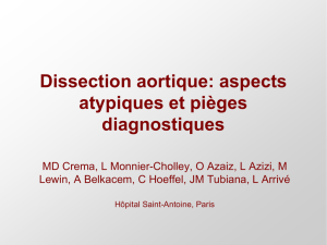 Dissection aortique: aspects atypiques et pièges diagnostiques