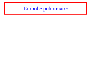 Embolie pulmonaire