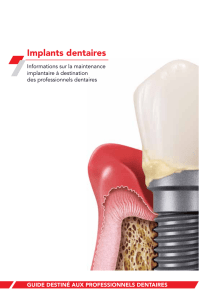 Colgate Brochure Dentiste Implant 0313