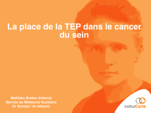 TEP-FDG cancer du sein - copie.key