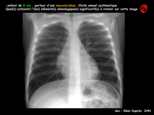 D CC thorax tumeur myofibroblastique inflammatoire