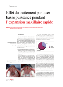 Effet du traitement par laser basse puissance pendant l`expansion