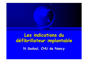 Les indications du défibrillateur implantable