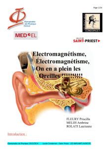 Memoire Implant auditif Soundbridge(VF6