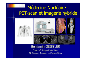 Médecine Nucléaire : PET-scan et imagerie hybride