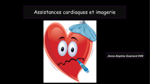 D CC cardio-vascul ssistance cardiaque et imagerie