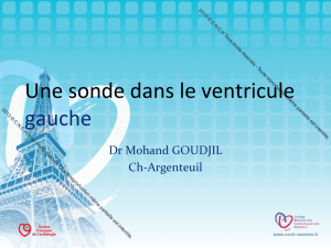 Une sonde dans le ventricule gauche