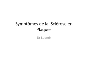 Symptômes de la Sclérose en Plaques