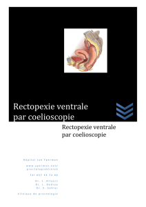 Rectopexie ventrale par coelioscopie
