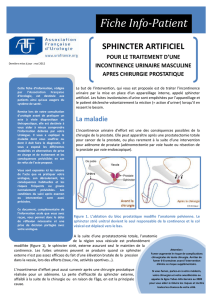 6 - Sphincter artificiel chez l`homme.pub