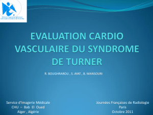 evaluation cardio vasculaire du syndrome de turner