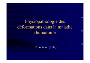 Physiopathologie déformation polyarthrite rhumatoïde C