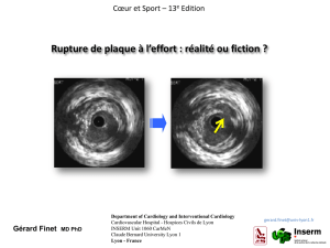 04-rupture-plaque-ef.. - Club des Cardiologues du Sport