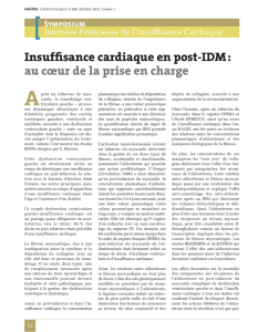 Insuffisance cardiaque en post-IDM