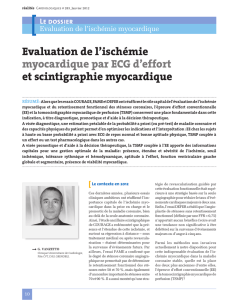 Evaluation de l`ischémie myocardique par ECG d`effort et