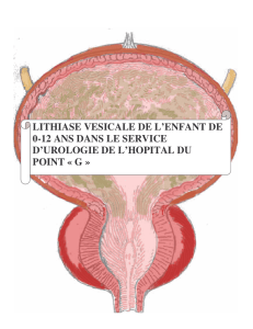 lithiase vesicale de l`enfant de 0-12 ans dans le service d`urologie