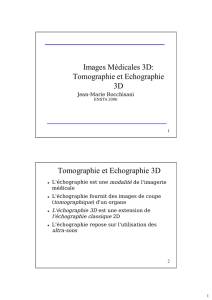 Images Médicales 3D: Tomographie et