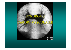 Syndrome vasculaire - Soutien Pneumologique International