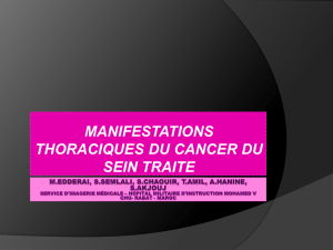 MANIFESTATIONS THORACIQUES DU CANCER DU SEIN TRAITE
