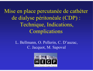 Mise en place percutanée de cathéter de dialyse péritonéale (CDP