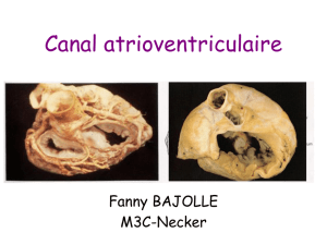 Canal atrioventriculaire